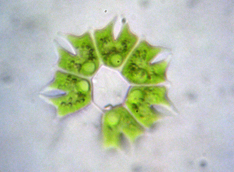 Pediastrum obtusum?